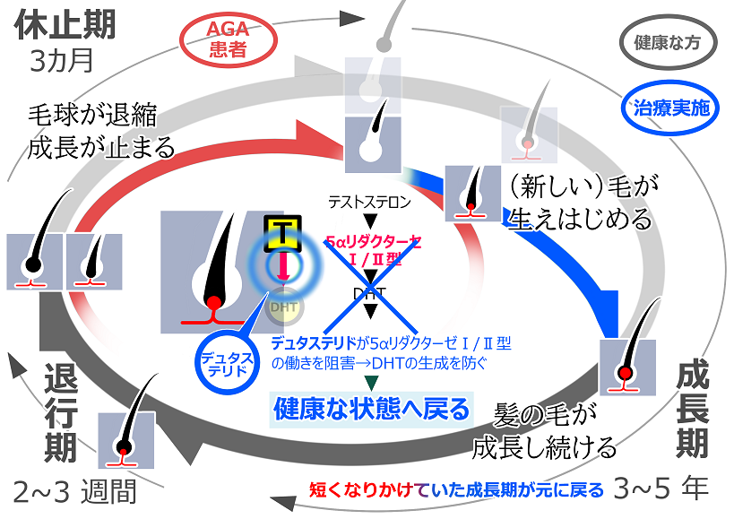 ヘアサイクル（デュタステリド使用時）